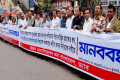 সংলাপের মাধ্যমে নিরপেক্ষ সরকারের অধীনে অবাধ নিরবাচন সহ বিভিন্ন দাবিতে বুধবার জাতীয় প্রেসক্লাবের সামনে মানব বন্ধন করে ডক্টরস এসোসিয়েশন অব বাংলাদেশ ড্যাব -পিএনএস